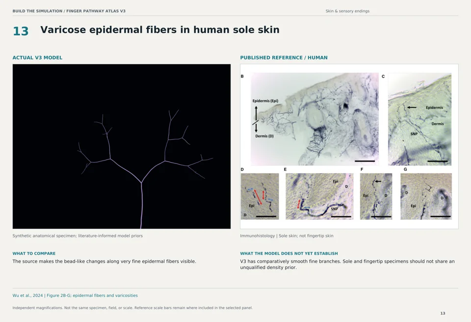 Varicose epidermal fibers in human sole skin: V3 model beside human immunohistology reference