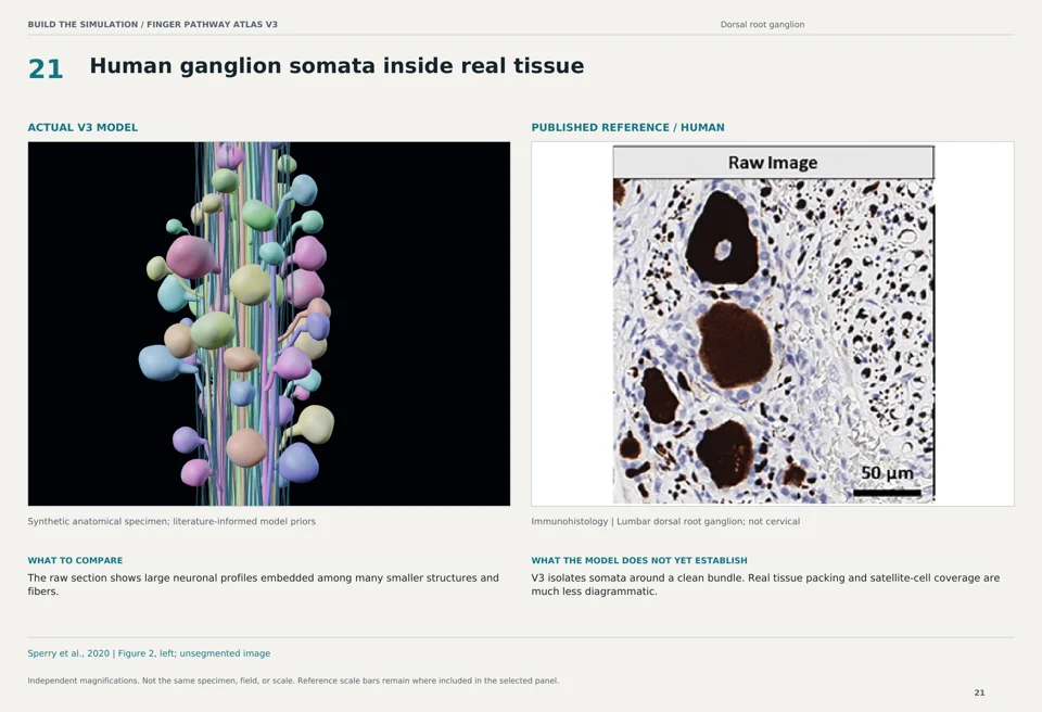 Human ganglion somata inside real tissue: V3 model beside human immunohistology reference
