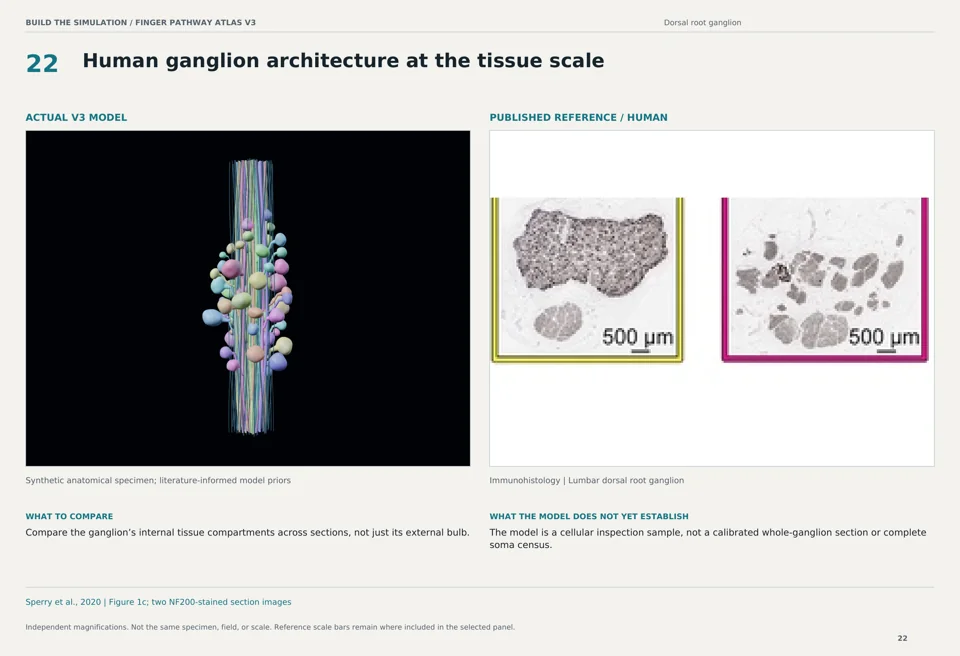 Human ganglion architecture at the tissue scale: V3 model beside human immunohistology reference