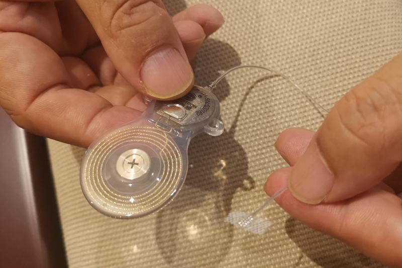 Photograph of the domestic auditory brainstem implant held in two hands, showing the circular receiver coil, implant package, lead and small electrode paddle.