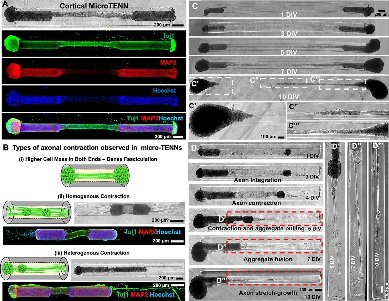 University of Pennsylvania Cullen Lab microscopic views and immunofluorescence of cortical micro-tissue engineered neural networks, with schematic and scale bars.