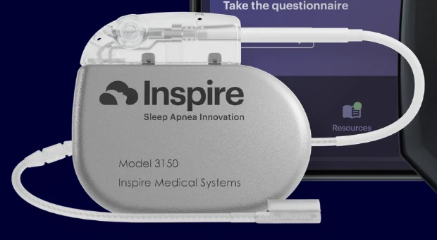 Inspire Model 3150 implant and attached white lead with a transparent connector header.