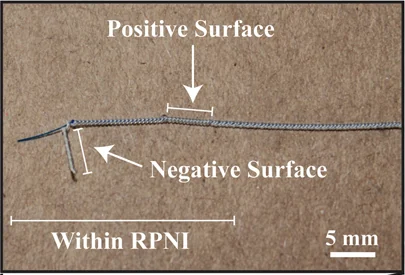Close-up of the implanted RPNI bipolar electrode contacts, labeled positive and negative surfaces, beside a 5 mm scale bar.